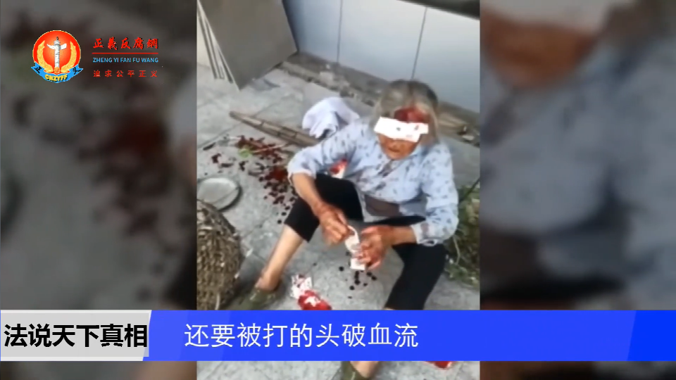 老人因卖樱桃被城管打的头破血流,遗弃在街头.png 老人因卖樱桃被城管打的头破血流,遗弃在街头.png